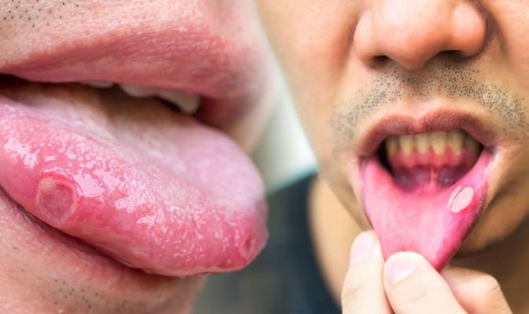 vitamin-b12-deficiency-sore-mouth-changes-that-may-be-a-symptom-of