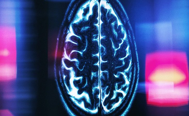 World-first: MRI study charts brain changes across human lifespan ...